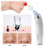 Limpiador Facial Extractor De Puntos Negros Eléctrico 4 En 1
